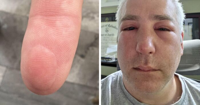 65 Photos Of The Human Body In Shapes And Conditions You Might Not Have Seen Before