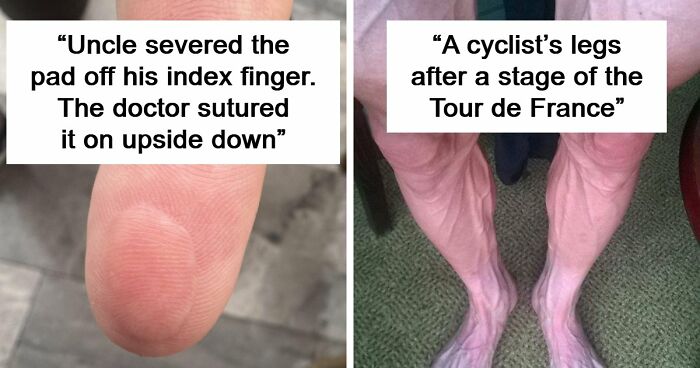 65 Photos Of The Human Body In Shapes And Conditions You Might Not Have Seen Before