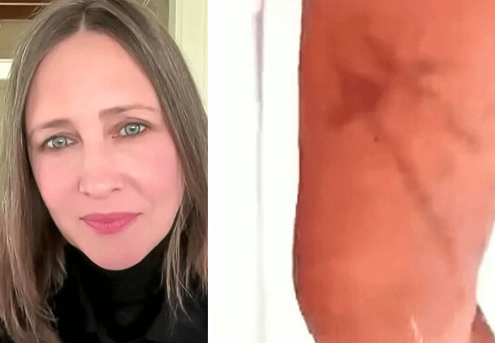 Woman with light brown hair and green eyes beside a close-up of an unusual skin pattern in strange earth images.