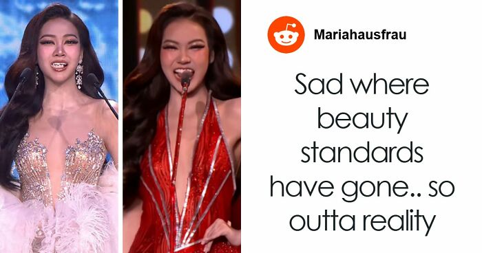 “How You Make A Comeback”: Beauty Queen’s Brilliant Follow-Up After Losing Her Teeth During Pageant