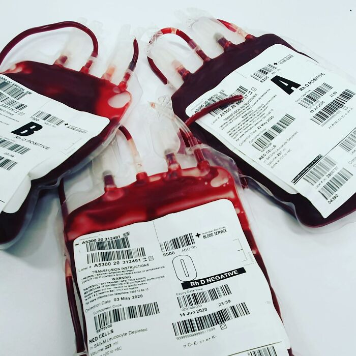 Blood bags labeled with different blood types, highlighting medical staff challenges in the ER.