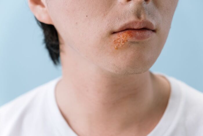 Close-up of a young man with food stuck on his lip, illustrating a disastrous first date moment and dating mishaps.