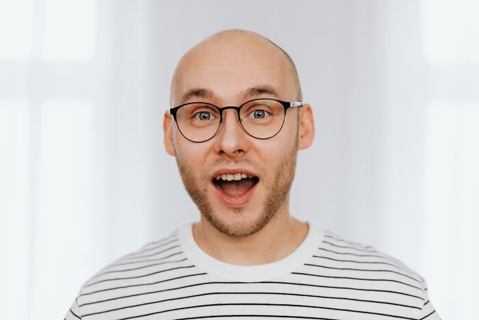 Surprised bald man with glasses wearing a striped shirt reacting to bizarre true stories nobody believed.