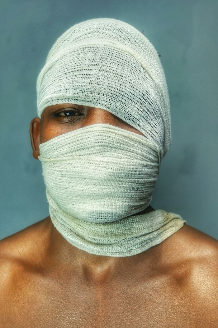 Person with head and face wrapped in medical gauze bandages, representing medical staff challenges in the ER.