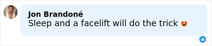 Comment on social media by Jon Brandon&eacute; saying sleep and a facelift will do the trick with heart eyes emoji.