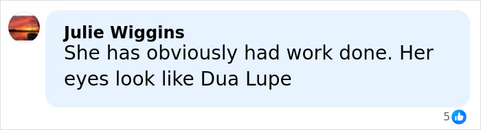 Comment by Julie Wiggins expressing opinion on Anne Hathaway&rsquo;s taut face and resemblance to another celebrity&rsquo;s eyes.