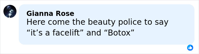 Comment about beauty police mentioning facelift and Botox in response to Anne Hathaway's taut face after Oscars appearance scrutiny.