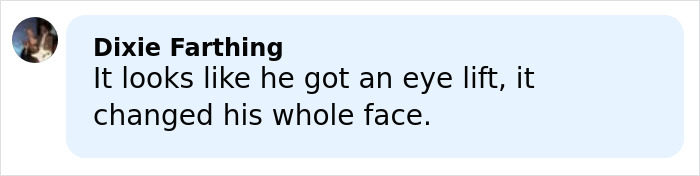 Comment by Dixie Farthing discussing changes to Jim Carrey’s face possibly due to an eye lift surgery. Comment by Dixie Farthing discussing changes to Jim Carrey’s face possibly due to an eye lift surgery.