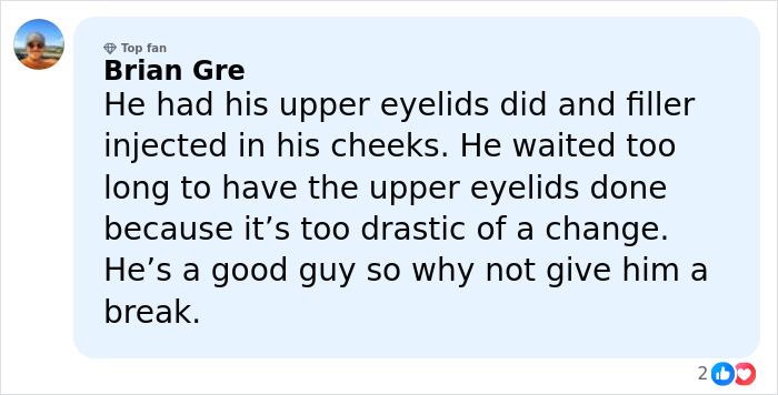 Comment by Brian Gre about filler injections and eyelid surgery on Jim Carrey’s face after controversy discussed by Dr. Terry Dubrow Comment by Brian Gre about filler injections and eyelid surgery on Jim Carrey’s face after controversy discussed by Dr. Terry Dubrow