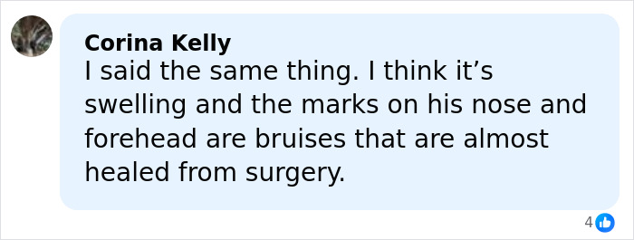 Comment from Corina Kelly discussing bruises and swelling on Jim Carrey’s face after surgery, with Dr. Terry Dubrow’s medical verdict. Comment from Corina Kelly discussing bruises and swelling on Jim Carrey’s face after surgery, with Dr. Terry Dubrow’s medical verdict.