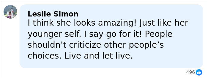 Comment praising Denise Richards facelift transformation, supporting personal choices with positive feedback.