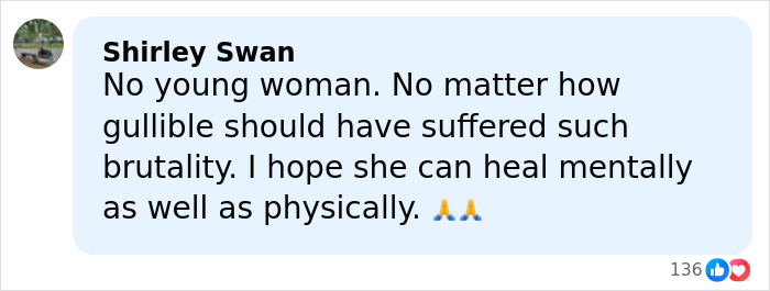 Model with horrific injuries posing for photos during her comeback on a Dubai roadside, showing strength and resilience.