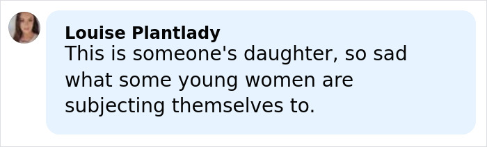 Model with horrific injuries posing confidently outdoors during her inspiring comeback on a Dubai roadside location.