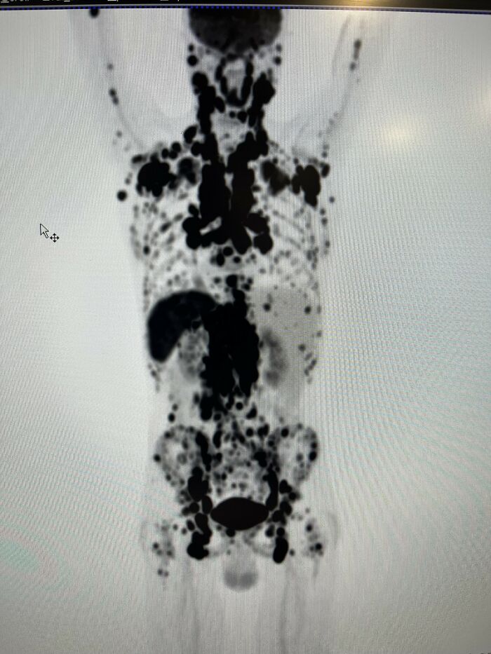 Full-body medical scan showing black spots representing abnormalities, illustrating scientific facts that might blow your mind today