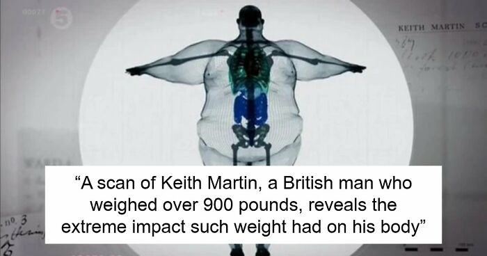 These 35 Horrifying Truths Might Leave You Tossing And Turning In Your Bed With Fear