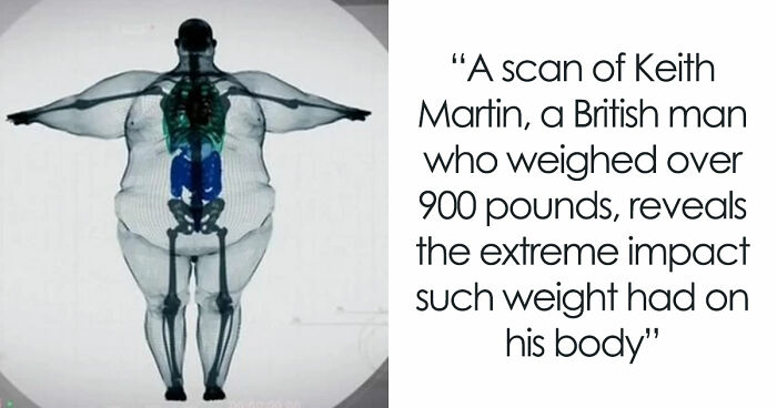 35 Disturbing Images And Facts Proving That Real Life Can Be An Absolute Nightmare