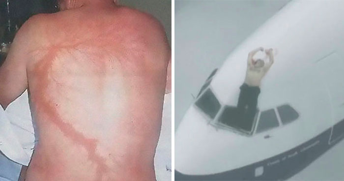 “Should Have Been 100% Fatal”: 49 Times Humans Survived The Most Terrifying Situations