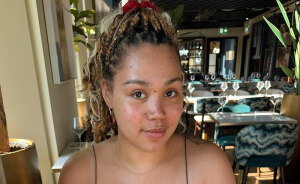 “Living A Nightmare”: ‘Bridgerton’ Actress Shows The Impact Her Mental Health Had On Her Body