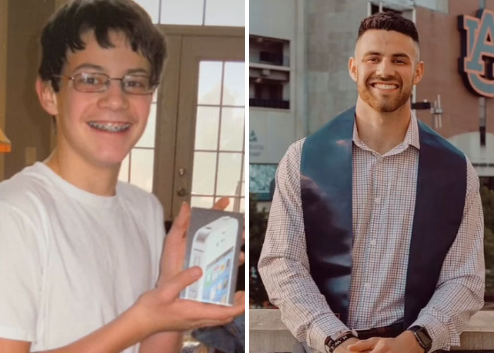 Side-by-side glow-up transformation showing extreme change in appearance from teenage years to adulthood.