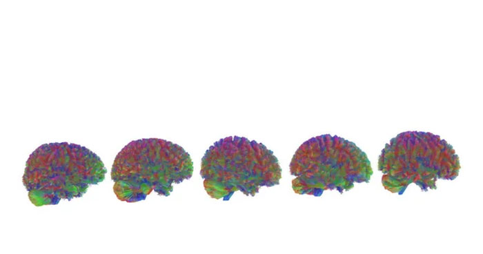 Five colorful brain scans arranged in a row illustrating neurological development related to entering adulthood at 32 years.