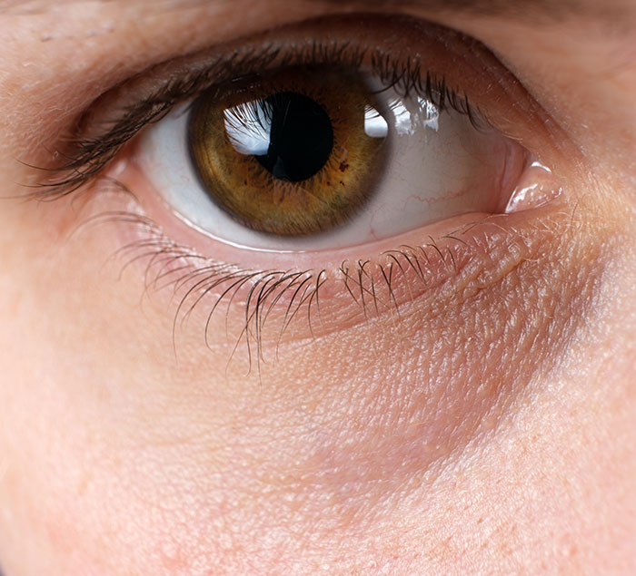 Close-up of a human eye showing tired eyes symptoms that make stars look sleepy despite youthful faces