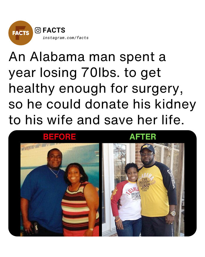 Before and after photos of an Alabama man who lost 70lbs for kidney donation to save his wife’s life in daily brain-care facts.