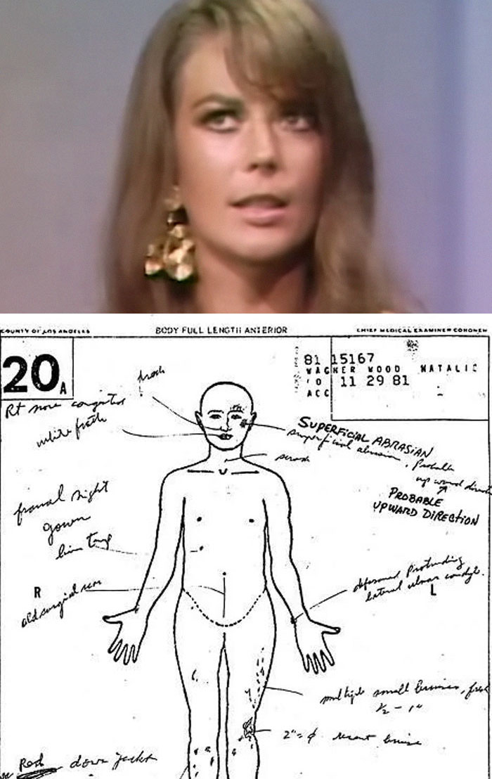 Unsettling mysteries image showing a woman's portrait above a detailed body autopsy sketch with handwritten notes.