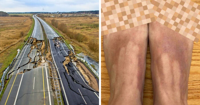 “What Could Possibly Go Wrong?”: 47 Times People Immediately Regretted Their Stupid Decisions (New Pics)