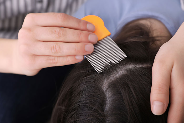 Close-up of a person using a lice comb on dark hair to treat a lice infestation after months of refusal.