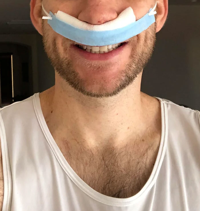 Man smiling with a nose bandage after surgery, illustrating hospital experiences that might deter future visits.