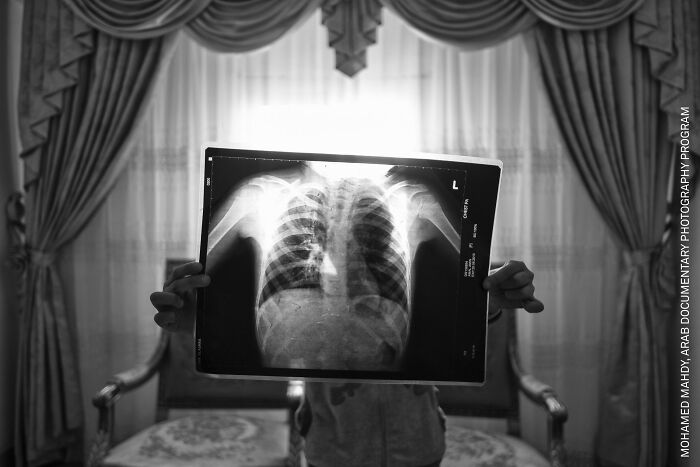 Africa, Long-Term Projects: Moon Dust By Mohamed Mahdy, Arab Documentary Photography Program