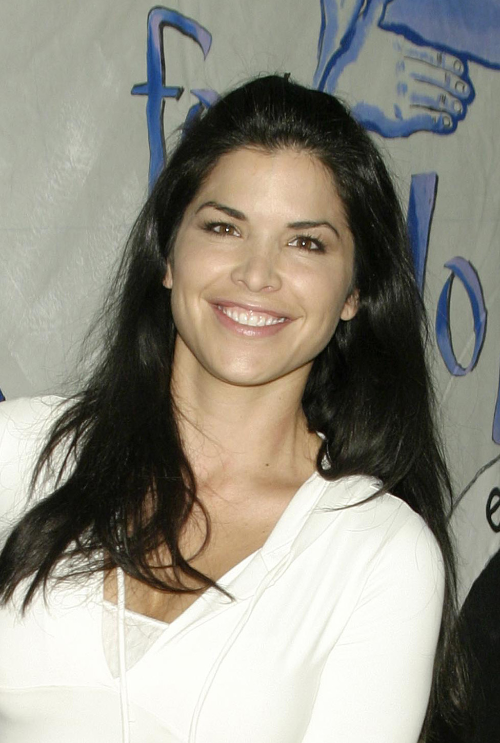 Lauren Sanchez Plastic Surgery Before And After: The "Mar-A-Lago Face" Explained