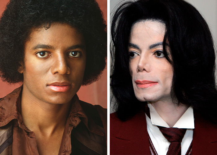 Side-by-side images showing Michael Jackson's transformation over the years due to plastic surgery changes.