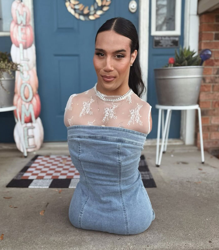 Influenciador trans sem braços ou pernas finalmente revela o que 