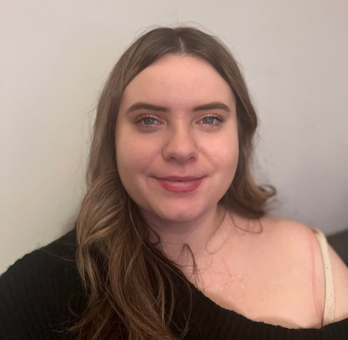 Mulher mostra sua transformação maluca, as pessoas não conseguem acreditar: "Preenchimento labial, botox, perda de peso"