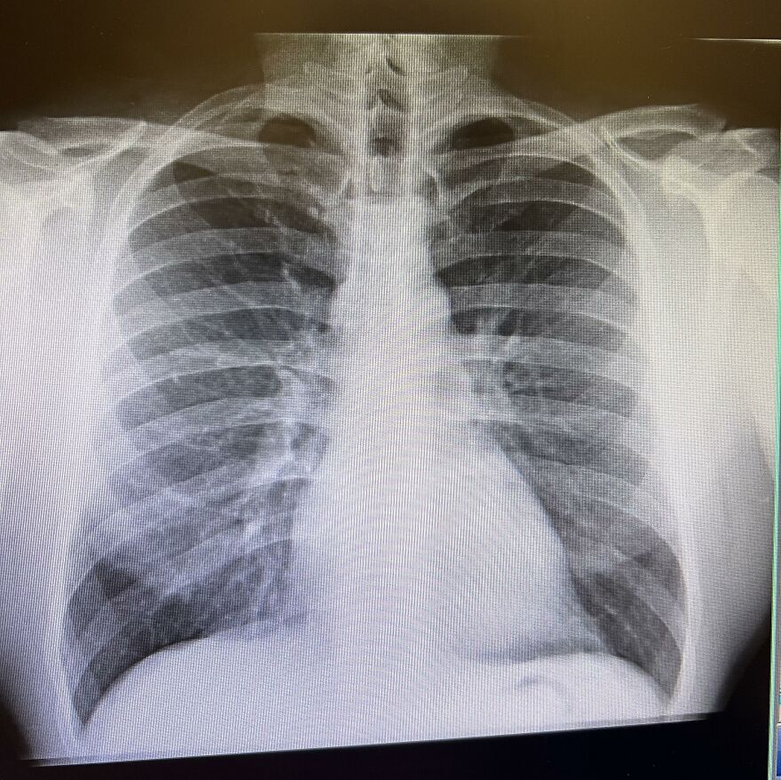 A detailed medical X-ray of a human chest, revealing bones, lungs, and heart, illustrating bizarre human body quirks.
