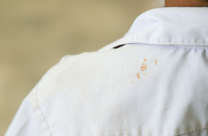 Close-up of a white shirt with brown, unappetizing stains on the back and shoulder, a gross office story.