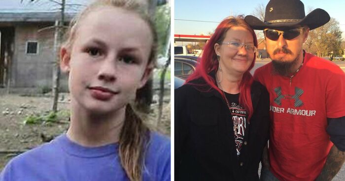 “Best Facial Harmonization I’ve Ever Seen”: 25 Before-And-Afters By A Plastic Surgeon Whose Work Went Viral