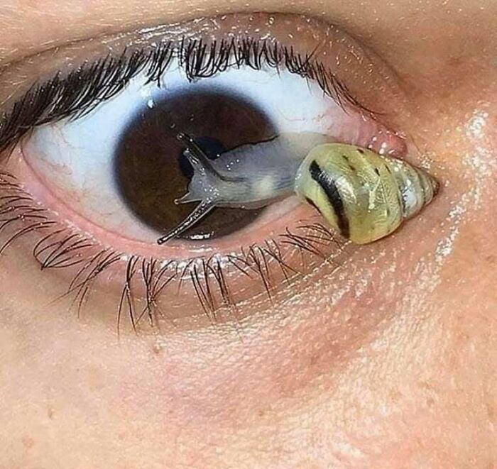 Close-up of a human eye with a small snail crawling on the lower eyelid in a confusing and unhinged image