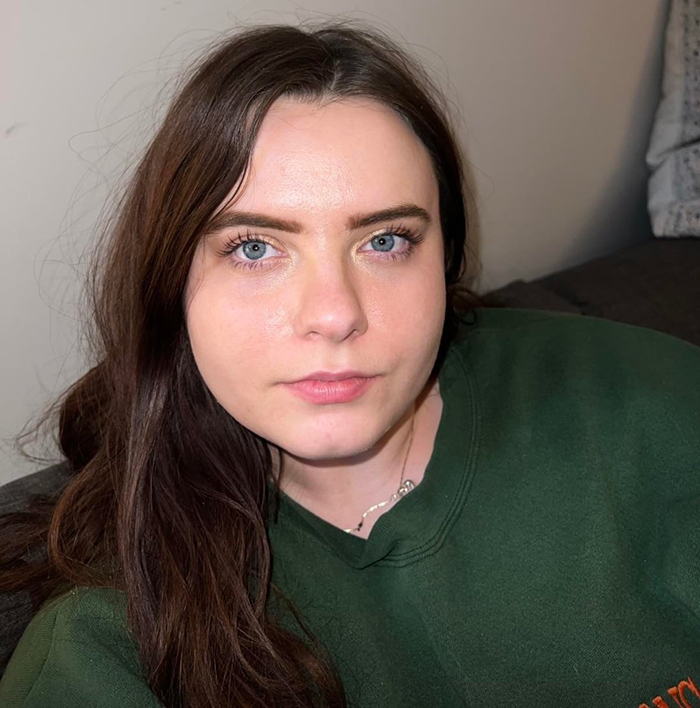 Mulher mostra sua transformação maluca, as pessoas não conseguem acreditar: "Preenchimento labial, botox, perda de peso"