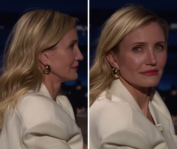 A visão simples de Cameron Diaz sobre Jimmy Fallon desperta um grande debate sobre cirurgia plástica