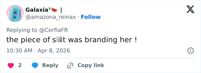 A woman sharing her tattoo removal transformation after being forced to get 250 name tattoos by her partner. A woman sharing her tattoo removal transformation after being forced to get 250 name tattoos by her partner.