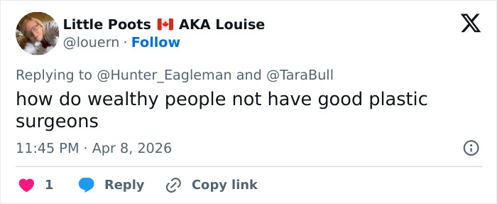 Tweet text on a social media platform discussing wealthy people and the topic of plastic surgery in a casual tone. Tweet text on a social media platform discussing wealthy people and the topic of plastic surgery in a casual tone.