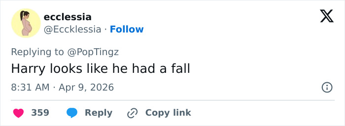 Lisa Rinna And Harry Hamlin Go Viral With Funny Recreation Of Kylie Jenner And Timoth&eacute;e Chalamet's Beach Pics