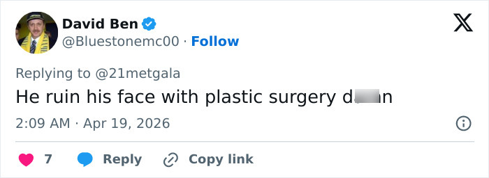 "O leite estragou": O novo visual do tapete vermelho de Adam Levine deixa os fãs atordoados