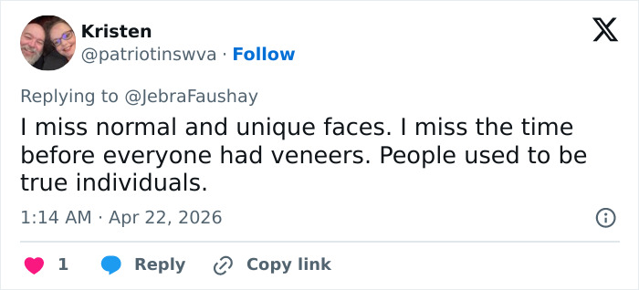 A visão simples de Cameron Diaz sobre Jimmy Fallon desperta um grande debate sobre cirurgia plástica