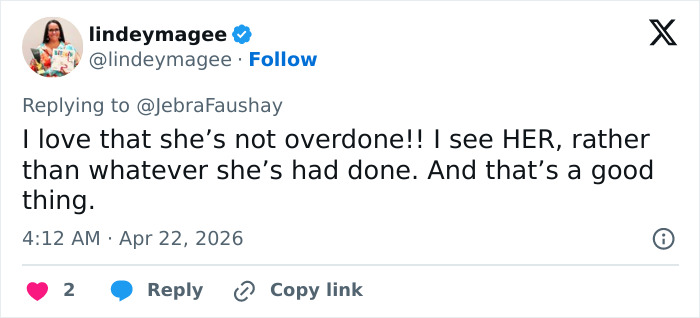 A visão simples de Cameron Diaz sobre Jimmy Fallon desperta um grande debate sobre cirurgia plástica