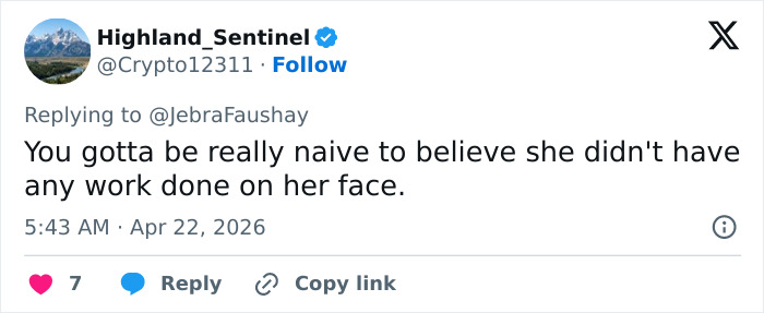 A visão simples de Cameron Diaz sobre Jimmy Fallon desperta um grande debate sobre cirurgia plástica