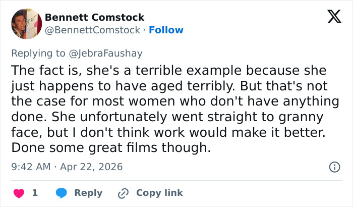 A visão simples de Cameron Diaz sobre Jimmy Fallon desperta um grande debate sobre cirurgia plástica