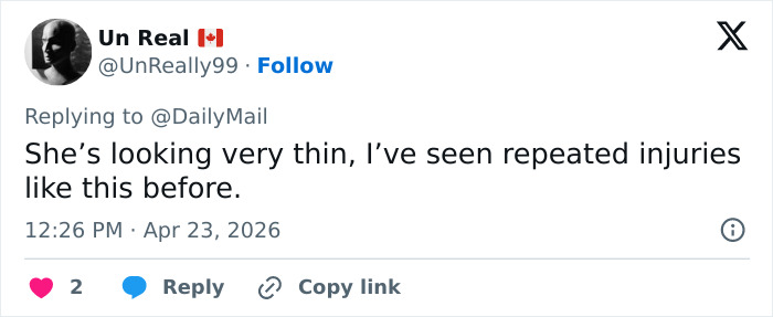 A mão enfaixada de Kate Middleton para as comemorações do centenário da falecida rainha Elizabeth gera especulações